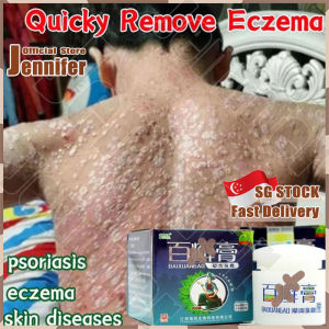 💥𝗦𝗚 𝗦𝗧𝗢𝗖𝗞💥 Bai X Gao Eczema cream herbal psoriasis ointment / Itchy skin cream / Ringworm cream / 百选膏 / 止痒膏 / 牛皮癣 / 百癣膏草本抑菌止痒乳膏 / 湿疹膏