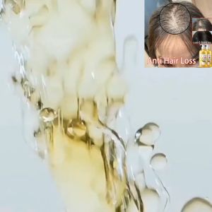 Hair growth shampoo Hair loss shampoo Anti dandruff shampoo500ml/box Ginger anti -hair loss Stimulate hair follicles to promote hair growth