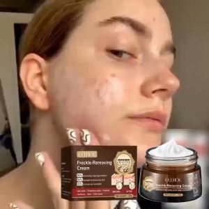 Eelhoe Anti-Blemish Cream Gentle Moisturizing Brightening Skin Facial Care Refreshing Non-Greasy