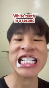 Pasta gigi anti alergi 110g Mencegah Sensitivitas Gigi Dengan Separatif Gigi yang Terpercaya Odol Pemutih Gigi dan Karang Gigi Pembersih Gigi Kuning dan Karang antiplaque pasta gigi Memperbaiki Gusi Rusak Mencegah Kerusakan Gigi Hapus Bau Mulut