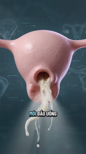 TRÀ CÂY MÂM XÔI SÂM TỐ NỮ ( 1 HỘP 60 TÚI LỌC . CÂN BẰNG NỘI TIẾT TỐ NỮ )