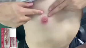 Private Parts Pink Tender Remove Pink Nipple 30ml Remove Melanin nipple whitening Private part whitening