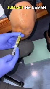 [COD][6 pieces/box] Mitsui Gout patch Gout patch toe joint neckshoulder pain knee swelling pain plaster Healthcare Therapeutic Treatment Therapy