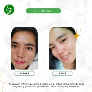 Paket 2in1 Toner Exfoliating & Cream Darkspot Liz Skincare toner wajah krim penghilang flek hitam