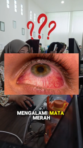 PAKET 3 BOTOL VISOSPECT KAPSUL OBAT MATA TERBAIK SEMBUH TUNTAS