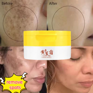 Astragalus Whitening Freckle Cream Face Remove Dark Spots Melasma Lighten Melanin Acne Scars Anti-aging Brighten Black Skin Care
