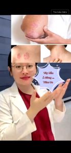 Kem Bôi Nấm Ngứa Viêm Da Cơ Địa - nguyên liệu NHẬT BẢN senka