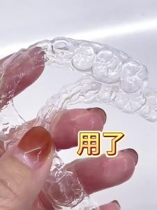 Orthodontic Retainer and Aligner Cleaner Effervescent Tablets