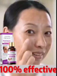 SADOER Whitening Freckle Essence Remove Dark Spots Anti Freckle Essence Niacinamide Fade Pigmentation Melasma Brighten Melasma Retinol Essence 100ML