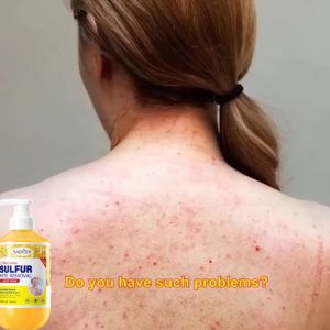 Sulfur mite removing shower gel with amino acids for mild acne and mite prevention moisturizing and rejuvenating 500ml for chicken skin removal