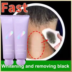 SADOER | Remove Melanin Nicotinamide Brightening Cream For Dark Skin Effective Lighten Thigh Inner Bleach Private Parts Brighten Cream