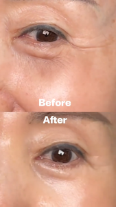 【SG Local Stock】ARENCIA Retinal Booster Shot Advanced Retinal & Caffeine Formula for Firm Pore-Refined Skin 30ml