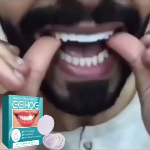 EELHOE Boleh Disesuaikan Gigi Palsu Jenis Kancing Kit Gigi Palsu Pembetulan Jurang Gigi Sementara
