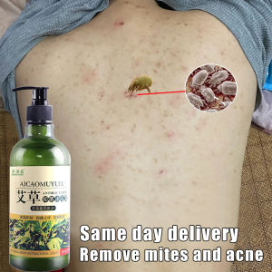 Acne body wash back acne bath essentials 500ml Acne shower gel In addition to mite Wormwood antibacterial shower gel Oil control Removal of mites Long lasting fragrance Skin relieves itching