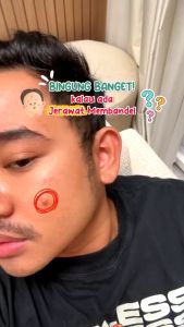 Skintific Pure Centella Acne Calming Toner 80ml Oil Control Purifying Toner Skin Barrier Smoothing Redness