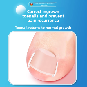 rimei | Embedded Nail Correction Toes Filler Spacer