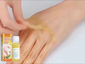 Jaysuing Yellow Peeling Oil Whitening Bleaching Moisturizing Yellow Peeling Oil For Whole Body Effect Remove Dark Skin Brightening Whiten Body Treatment Peeling Oil Lighten Elbows Knees Hands Skin Body Peeling Oil Lighten Elbows Knees Hands Skin Body