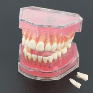 Dental Study Teaching Model Standard Model Removable Teeth Soft Gum ADULT TYPODONT Model