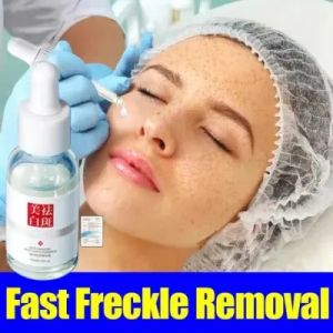 Menghilangkan Bercak Gelap di Wajah: Krim Pemutih & Penyegelan