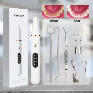 G6 Ultrasonic Dental Calculus Remover: A Professional Dental Cleaning Tool