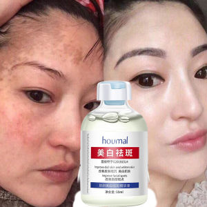 Nicotinamide Whitening Freckle Serum dark spot remover krim jeragat degil berkesan pigmentation treatment brighten melanon skincare-50ml 烟酰胺美白祛斑霜