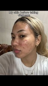 VITABEARS: The Ultimate Guide to Skin Collagen Peptide Gummies