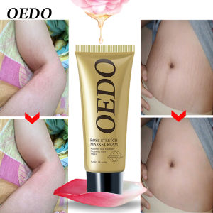 OEDO Rose Remove Stretch Marks Cream Anti Wrinkle Anti Aging Maternity Skin Repair Remove Pregnancy Scars Treatment Body Skin Care 40g