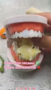 Penambal Gigi Paling Kuat & Aman: Solusi untuk Gigi Renggang & Ompong