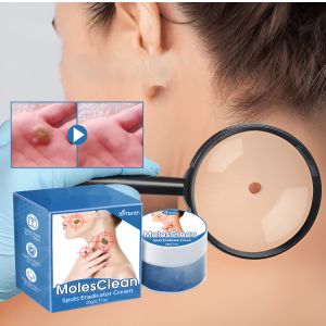 Wart Cream & Dark Moles: A Comprehensive Guide