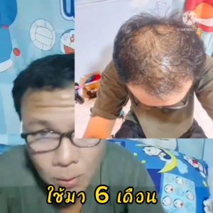 แชมพูสมุนไพรคุณยาย สมุนไพรไทย 17 ชนิด ผมบาง ผมร่าง ผมมัน เร่งผมเกิดใหม่