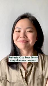 NPURE Face Toner Centella Asiatica - Anti Acne Toner / Toner Kulit Jerawat Berminyak