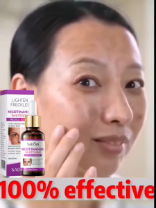 Essensi Pemutih Wajah SADOER untuk Menghilangkan Flek & Noda Hitam