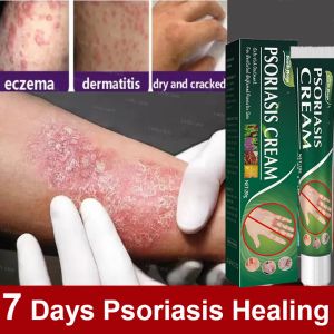 Antibacterial Cream Itchy Skin Cream Relieving Eczema Ointment Natural Anti Fungal Anti Bacteria Anti Viral For Sensitive Skin Itch Redness Hand Foot Skin Problems Psoriasis Treatment Cream 20g