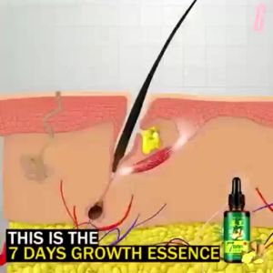 Serum 7 Days Hair Tonic Ginseng 20ML Rambut Rontokmenghitamkan uban Ampuh Menumbuhkan Rambut Botak & Mencegah Kerontokkan-SS