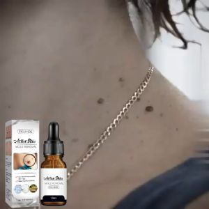 EELHOE Wart Removal Serum Esensi Penghilang  Esensi Penghilang Kutil Mudah Dibawa Untuk Semua Kulit Esensi Penghilang Kutil