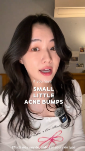 SKINEVER Salicylic Acid Exfoliating Toner Gentle Exfoliation | Oil Control | Pore Refining & Smoothing For Oily & Blemish-Prone Skin