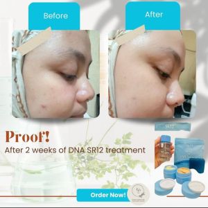 PAKET DNA SALMON SR12 - DNA SALMON SERIES SR12 - Paket Wajah Glowing DNA SALMON SR12