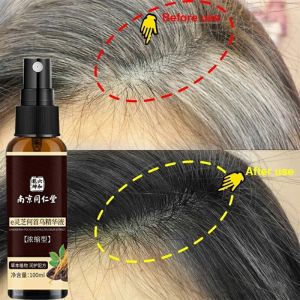 Herbal gray hair spray Polygonum multiflorum herbal extract hair treatment 3 days black hair serum white hair to black/Black hair shampoo 100ml anti hair loss treatment white hair nourishing repair deep cleaning oil control 一喷就黑何首乌乌发液洗发水去白发转黑发永久变黑神器防脱发