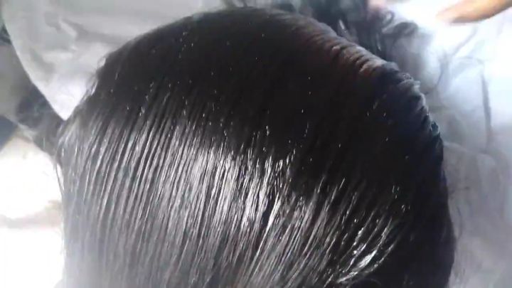 Obat Kutu Rambut Paling Ampuh OBAT KUTU RAMBUT AMPUH DAN TELUR KUTU PEMBERSIH KUTU RAMBUT PEMBASMI KUTU RAMBUT PENGHILANG KUTU RAMBUT