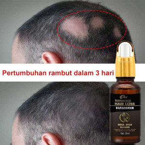 Serum Rambut Untuk Pertumbuhan Cepat & Tebal