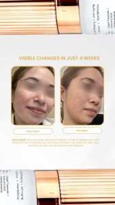 Pathe Beauty Glow Up Serum