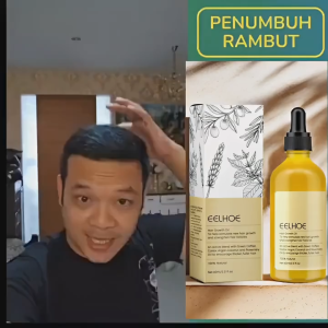 Rosemary oil for hair growth Serum Hair losstreatment hair tonic growth Pelebat rambut Rambut Gugur Hair Fall Serum Hair Essential Oil 迷迭香密发精油