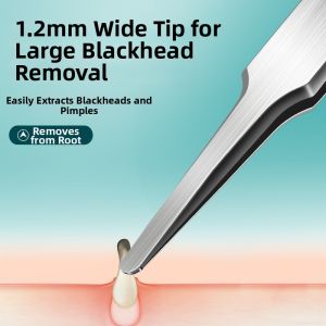 YALIKANG | Blackhead Removal Precision Beauty Salon Tool Acne Pliers