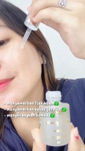 Jglow Skincare Serum Flek Spot Exfloating serum mengangkat kulit mati pencerah wajah isi 20 ml