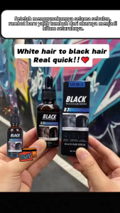 ORI Penghitam Rambut Serum Penumbuh Rambut Cepat Bahan Herbal Menghitamkan Rambut Secara Alami 30ML Rambut Hitam Lebat Secara Permanen Merawat Akar Rambut Bahan Alami Murni Aman Dan Tidak Merusak Rambut - serum penumbuh rambut hitam - penumbuh rambut botak