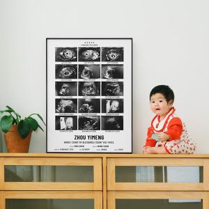 yishujia office | Customized HD Print Ultrasound Image Frame