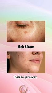 Paket Hemat Basic Cleansing Untuk Flek Hitam Paket 2 (Milk Cleanser + Facial Wash Coffee + Sunblock)