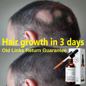 【7 Day Hair Growth】Hair Tonic Hair Growth Serum Ubat Rambut Gugur lelaki Hair tonic Plant Essence Natural Hair Loss Herbal Anti Hair Loss Promote Hair Growth Anti hair loss Hair growth serum Natural conditioner Natural plant essence 60ml Hair care Hair