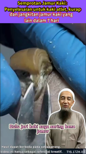 [✅COD]Fillizi Solusi Perawatan Kaki Tangan Ekstrak Tanaman Pelindung Tubuh Krim perawatan