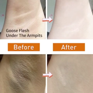 Whitening Underarm Cream 50g with Powerful Antioxidants Quick Whitening Advanced Brightening